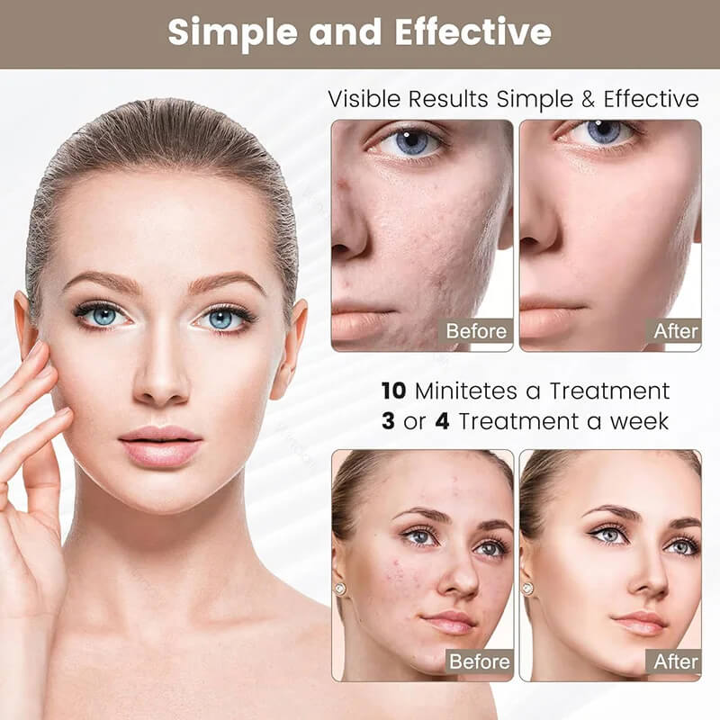 Light Beauty Mask